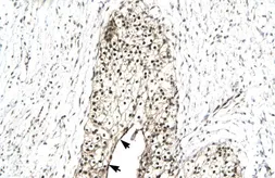 Anti-RUVBL2 antibody, N-term used in IHC (Paraffin sections) (IHC-P). GTX77831
