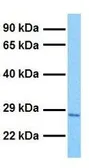 Anti-Claudin 8 antibody, C-term used in Western Blot (WB). GTX77832