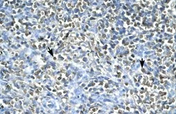 Anti-ASGR2 antibody, N-term used in IHC (Paraffin sections) (IHC-P). GTX77833