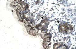Anti-PARP3 antibody, C-term used in IHC (Paraffin sections) (IHC-P). GTX77839