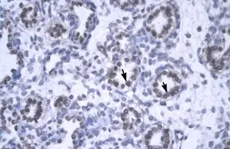 Anti-GAS41 antibody, Internal used in IHC (Paraffin sections) (IHC-P). GTX77840