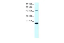Anti-MMP19 antibody, C-term used in Western Blot (WB). GTX77841