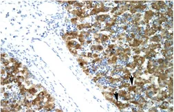 Anti-NFYA antibody, C-term used in IHC (Paraffin sections) (IHC-P). GTX77851