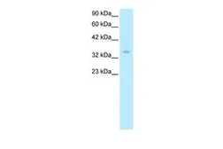 Anti-ZNF391 antibody, N-term used in Western Blot (WB). GTX77864