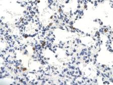 Anti-NCOA62 antibody, N-term used in IHC (Paraffin sections) (IHC-P). GTX77874
