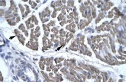 Anti-EYA3 antibody, Internal used in IHC (Paraffin sections) (IHC-P). GTX77877