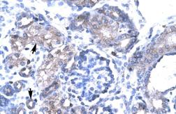 Anti-TBX19 antibody, N-term used in IHC (Paraffin sections) (IHC-P). GTX77878