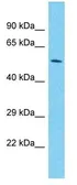 Anti-PAX7 antibody, C-term used in Western Blot (WB). GTX77888