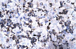 Anti-FOXP3 antibody, N-term used in IHC (Paraffin sections) (IHC-P). GTX77889