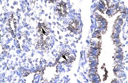 Anti-TIP30 antibody, N-term used in IHC (Paraffin sections) (IHC-P). GTX77890