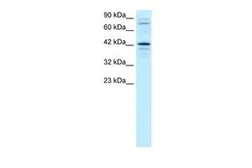 Anti-SOX18 antibody, Internal used in Western Blot (WB). GTX77891