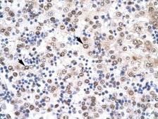 Anti-IRF8 antibody, N-term used in IHC (Paraffin sections) (IHC-P). GTX77895