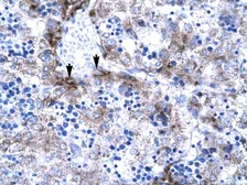 Anti-PC4 antibody, Internal used in IHC (Paraffin sections) (IHC-P). GTX77897