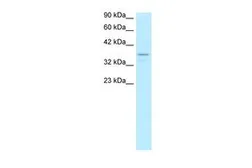 Anti-TAF7 antibody, N-term used in Western Blot (WB). GTX77898