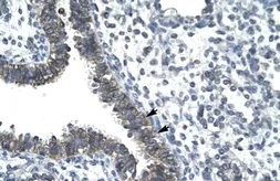 Anti-Nocturnin antibody, N-term used in IHC (Paraffin sections) (IHC-P). GTX77906