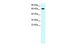 Anti-PIAS3 antibody, C-term used in Western Blot (WB). GTX77910