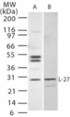 Anti-IL27 antibody used in Western Blot (WB). GTX77915