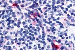 Anti-CXCR6 antibody used in IHC (Paraffin sections) (IHC-P). GTX77935