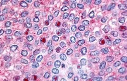 Anti-HNF4 gamma antibody used in IHC (Paraffin sections) (IHC-P). GTX78089