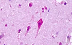 Anti-5-HT7 receptor antibody used in IHC (Paraffin sections) (IHC-P). GTX78121