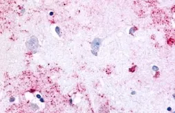 Anti-PAK6 antibody used in IHC (Paraffin sections) (IHC-P). GTX78127