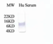 Anti-C3 / C3a antibody used in Western Blot (WB). GTX78198
