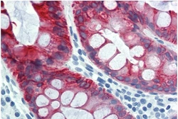 Anti-Cytokeratin 18 antibody [DC-10] used in IHC (Paraffin sections) (IHC-P). GTX78238