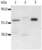 Anti-CD4 antibody [MEM-115] used in Immunoprecipitation (IP). GTX78249