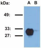 Anti-HLA-DR1 antibody [MEM-267] used in Western Blot (WB). GTX78393
