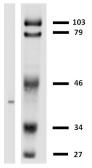 Anti-HLA-G antibody [MEM-G/2] used in Western Blot (WB). GTX78394