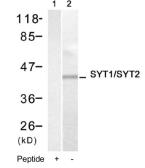 Anti-Synaptotagmin I/II antibody used in Western Blot (WB). GTX78914