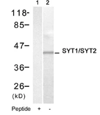 Anti-Synaptotagmin I/II antibody used in Western Blot (WB). GTX78914