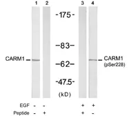 Anti-CARM1 antibody used in Western Blot (WB). GTX78920