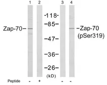 Anti-ZAP70 (phospho Tyr319) antibody used in Western Blot (WB). GTX78922