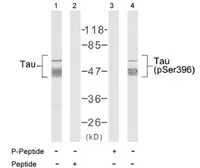 Anti-Tau (phospho Ser396) antibody used in Western Blot (WB). GTX78930