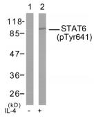 Anti-STAT6 (phospho Tyr641) antibody used in Western Blot (WB). GTX78935