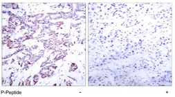 Anti-STAT6 (phospho Thr645) antibody used in IHC (Paraffin sections) (IHC-P). GTX78936