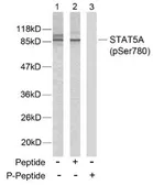 Anti-STAT5A (phospho Ser780) antibody used in Western Blot (WB). GTX78937