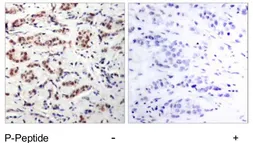 Anti-STAT5A (phospho Tyr694) antibody used in IHC (Paraffin sections) (IHC-P). GTX78938