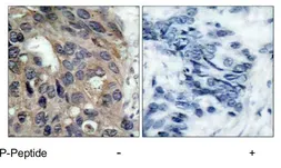 Anti-Src (phospho Tyr527) antibody used in IHC (Paraffin sections) (IHC-P). GTX78941