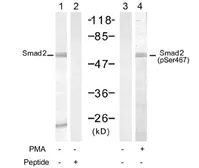 Anti-SMAD2 (phospho Ser467) antibody used in Western Blot (WB). GTX78943