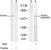 Anti-Smad1 (phospho Ser465) antibody used in Western Blot (WB). GTX78944