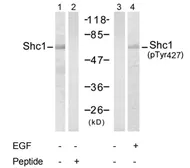 Anti-SHC1 (phospho Tyr317) antibody used in Western Blot (WB). GTX78947