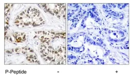 Anti-RelB (phospho Ser552) antibody used in IHC (Paraffin sections) (IHC-P). GTX78951