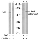 Anti-RelB (phospho Ser552) antibody used in Western Blot (WB). GTX78951
