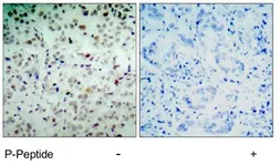 Anti-Rb (phospho Ser780) antibody used in IHC (Paraffin sections) (IHC-P). GTX78952