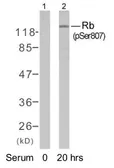 Anti-Rb (phospho Ser807) antibody used in Western Blot (WB). GTX78953