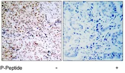 Anti-Rb (phospho Ser795) antibody used in IHC (Paraffin sections) (IHC-P). GTX78954