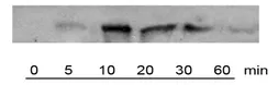 Anti-Raf1 (phospho Ser338) antibody used in Western Blot (WB). GTX78956