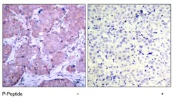 Anti-PTEN (phospho Ser380) antibody used in IHC (Paraffin sections) (IHC-P). GTX78960